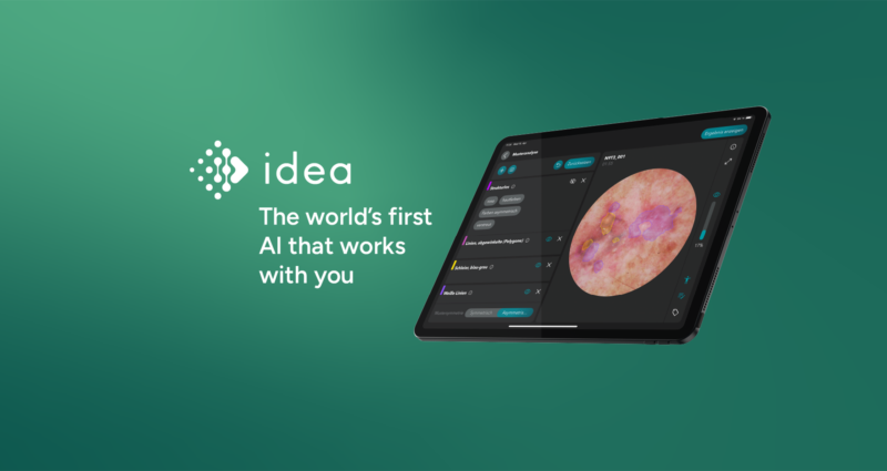 Magnosco presents AI assistant for skin cancer diagnostics