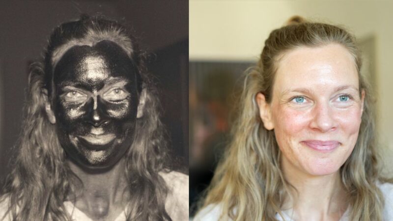 UV Protection Saves Skin – May Is Skin Cancer Awareness Month